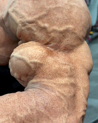 photo-thumb