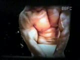 Thumb 6