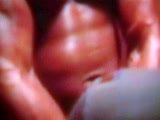 Thumb 9
