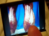 Thumb 9