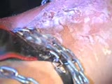 Thumb 6