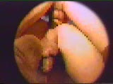 Thumb 8