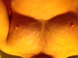 Thumb 6