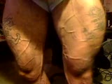 Thumb 9