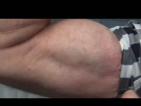 Thumb 10