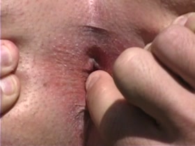 Thumb 8