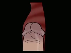 Thumb 6