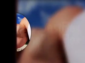 Thumb 20