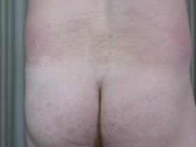 Thumb 18