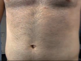 Thumb 9