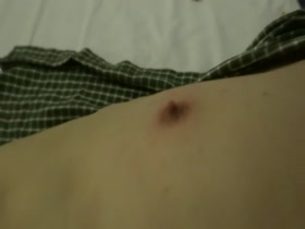 Thumb 10