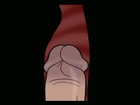 Thumb 6