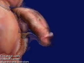 Thumb 12