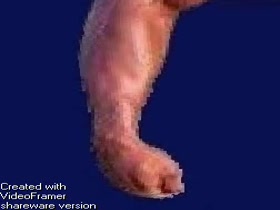 Thumb 8