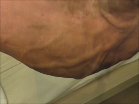 Thumb 13