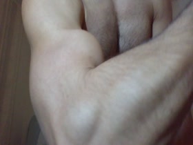Thumb 6