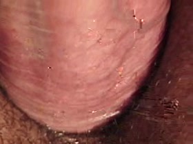 Thumb 16