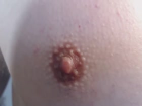 Thumb 10