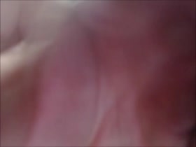 Thumb 8