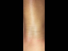 Thumb 18
