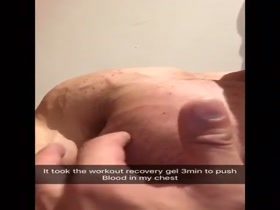 Thumb 19