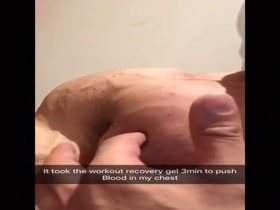 Thumb 20