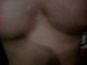 Thumb 20