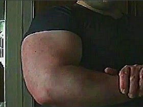 Thumb 1