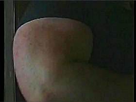Thumb 10