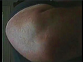 Thumb 15