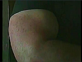 Thumb 8