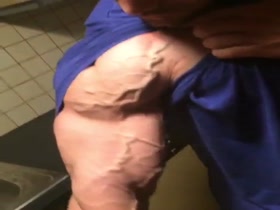 Thumb 10
