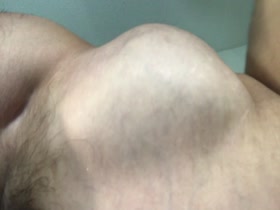 Thumb 20
