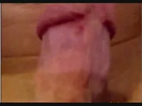 Thumb 17
